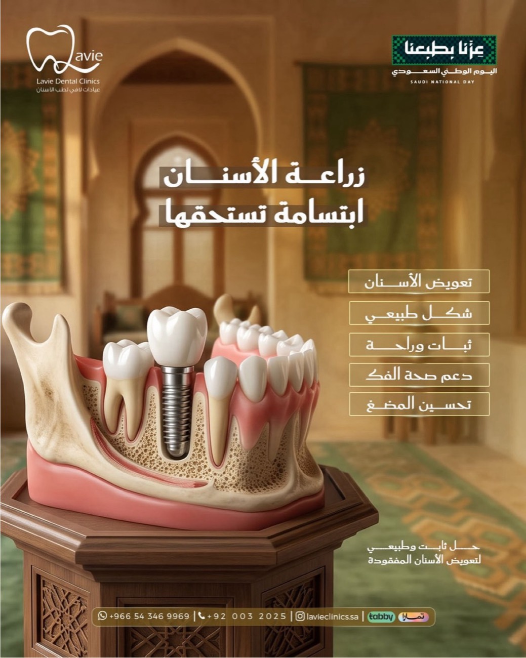 تصميم زراعة الأسنان