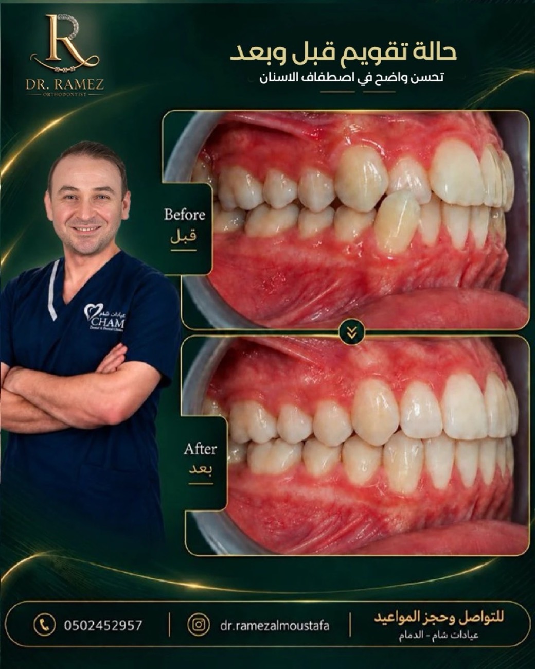 د. رامز — قبل وبعد
