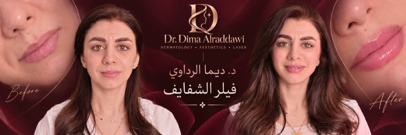 د. ديما — قبل وبعد