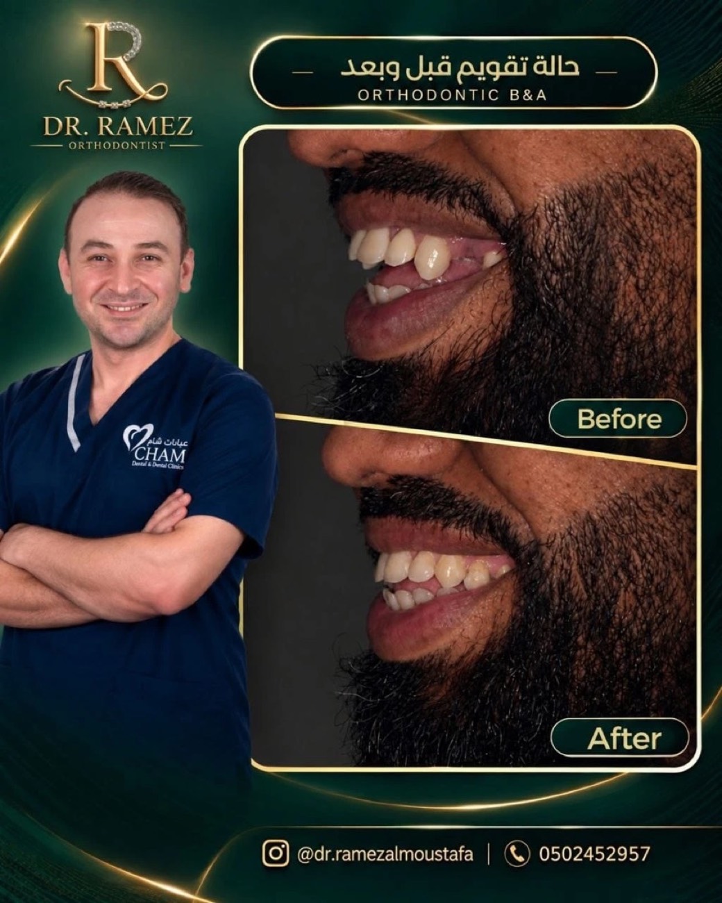 Dr. Ramez Almoustafa — تصاميم تقويم أسنان · الدمام